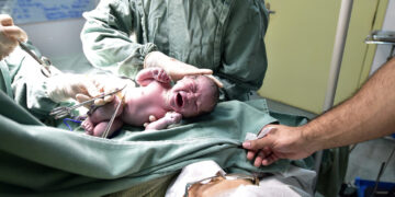 Lei estadual proíbe cobrança de qualquer valor do pai ou acompanhante para assistir ao parto