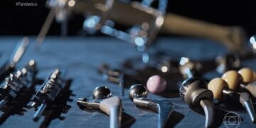 Reportagem no Fantástico revela suposto esquema de cirurgias ortopédicas de empresa com município e Governo do Estado