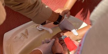 Bombeiros fazem retirada de anel preso em dedo de mulher