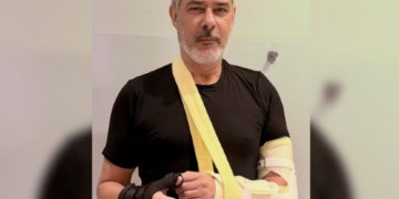 William Bonner mostra braço quebrado após acidente