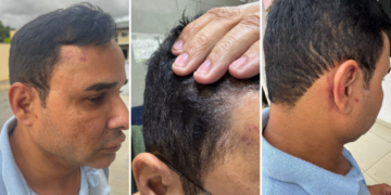 Sargento da PM nega ter dado soco em mulher e alega ter sido agredido