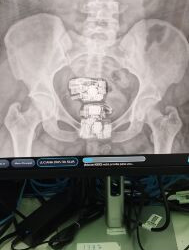 Mulher esconde 2 celulares, 4 carregadores e 8 cabos USB no corpo para entregar a preso