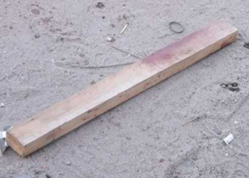 Mulher tem braço e costela quebrados após ser agredida a pauladas pelo ex