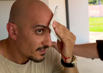 Líder da oposição na Austrália fere cinegrafista de TV acidentalmente; veja VÍDEO