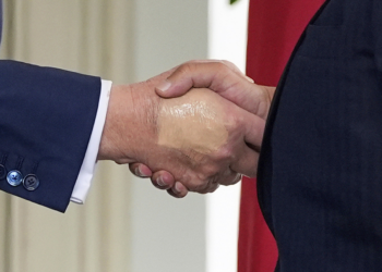 Trump foi flagrado com mão maquiada e pés inchados antes de diagnóstico de insuficiência venosa crônica; VEJA FOTOS