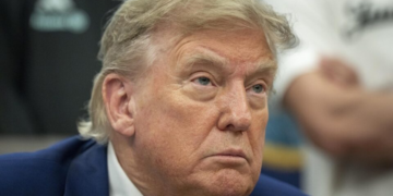 A doença de Trump: o que é a insuficiência venosa crônica e como ela pode ser tratada