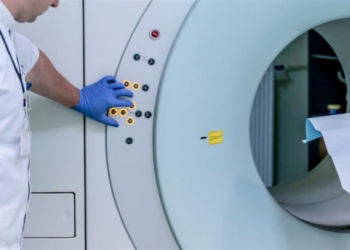 Acúmulo de ferro no cérebro indica risco de Parkinson, diz estudo