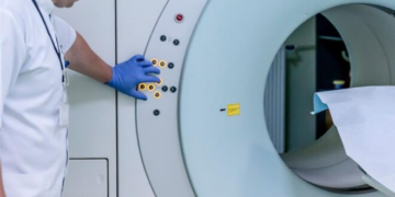 Acúmulo de ferro no cérebro indica risco de Parkinson, diz estudo