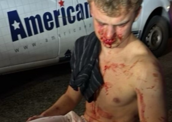 Agressão contra 'Big Balls', funcionário público de 19 anos, motivou Trump a intervir na segurança de Washington