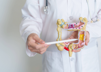 Câncer colorretal é mais agressivo entre os jovens, diz estudo brasileiro