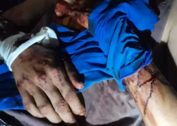 Peão é atacado por onça-pintada no Pantanal