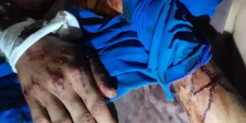 Peão é atacado por onça-pintada no Pantanal