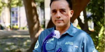 A impressionante história do mexicano que sobreviveu a mordida de tubarão na cabeça