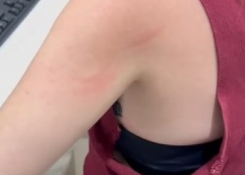 Médica é agredida por paciente em surto na UPA Morada do Ouro em Cuiabá; vídeo