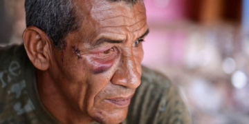 'Nunca pensei que fossem me atacar': os sobreviventes de ataque com míssil durante bombardeios dos EUA à Venezuela