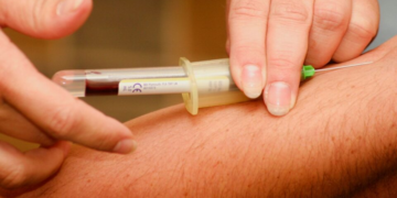 Cientistas brasileiros avançam em diagnóstico de Alzheimer a partir de exames de sangue