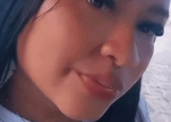 Brasileira morre após passar por cirurgias plásticas na Bolívia