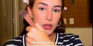 Brasileira recebe conta de R$ 84 mil em hospital dos EUA após mordida de cachorro