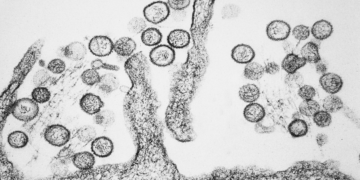 Testes de hantavírus deram negativo em pacientes suspeitos na Itália e na Espanha