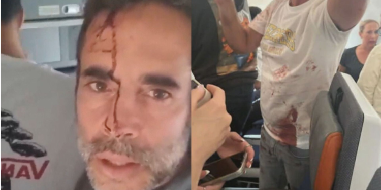 Ataque em avião: copiloto disse em depoimento que agiu sozinho, segundo Israel