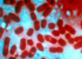 Rússia descarta risco de epidemia após morte de funcionária de laboratório por peste